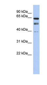 MYST2 / HBO1 Antibody - MYST2 antibody Western blot of OVCAR-3 cell lysate. This image was taken for the unconjugated form of this product. Other forms have not been tested.