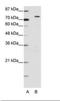 MYST2 / HBO1 Antibody - A: Marker, B: 293T Cell Lysate.  This image was taken for the unconjugated form of this product. Other forms have not been tested.