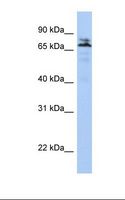 MYST2 / HBO1 Antibody - Jurkat cell lysate. Antibody concentration: 1.0 ug/ml. Gel concentration: 12%.  This image was taken for the unconjugated form of this product. Other forms have not been tested.