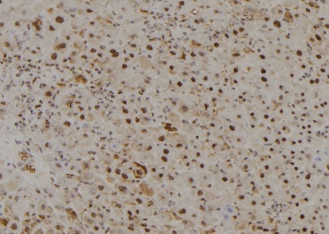 MYST3 / MOZ Antibody - 1:100 staining mouse liver tissue by IHC-P. The sample was formaldehyde fixed and a heat mediated antigen retrieval step in citrate buffer was performed. The sample was then blocked and incubated with the antibody for 1.5 hours at 22°C. An HRP conjugated goat anti-rabbit antibody was used as the secondary.