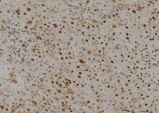 MYST3 / MOZ Antibody - 1:100 staining mouse liver tissue by IHC-P. The sample was formaldehyde fixed and a heat mediated antigen retrieval step in citrate buffer was performed. The sample was then blocked and incubated with the antibody for 1.5 hours at 22°C. An HRP conjugated goat anti-rabbit antibody was used as the secondary.