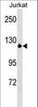 MYT1 Antibody - MYT1 Antibody western blot of Jurkat cell line lysates (35 ug/lane). The MYT1 antibody detected the MYT1 protein (arrow).
