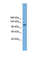 MYT1 Antibody - MYT1 antibody Western blot of Mouse Uterus lysate. This image was taken for the unconjugated form of this product. Other forms have not been tested.