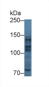 MYT1 Antibody - Western Blot; Sample: Human A549 cell lysate; Primary Ab: 3µg/ml Rabbit Anti-Mouse MYT1 Antibody Second Ab: 0.2µg/mL HRP-Linked Caprine Anti-Rabbit IgG Polyclonal Antibody