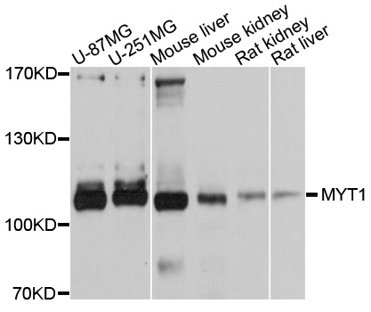 MYT1 Antibody - Western blot analysis of extracts of various cell lines, using MYT1 antibody at 1:1000 dilution. The secondary antibody used was an HRP Goat Anti-Rabbit IgG (H+L) at 1:10000 dilution. Lysates were loaded 25ug per lane and 3% nonfat dry milk in TBST was used for blocking. An ECL Kit was used for detection and the exposure time was 5s.