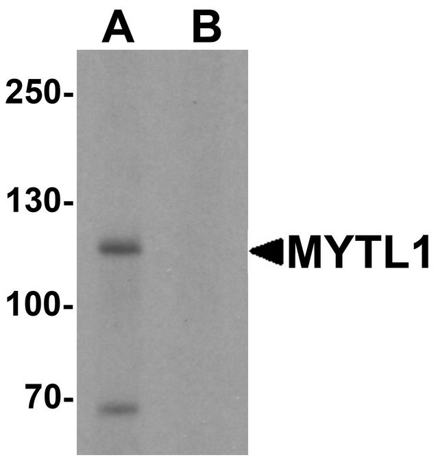 MYT1L Antibody - Western blot analysis of MYT1L in mouse brain tissue lysate with MYT1L antibody at 1 ug/ml in (A) the absence and (B) the presence of blocking peptide.