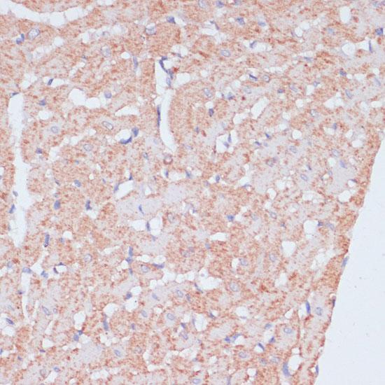 MZB1 Antibody - Immunohistochemistry of paraffin-embedded Rat heart using MZB1 Polyclonal Antibody at dilution of 1:100 (40x lens).