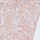 MZB1 Antibody - Immunohistochemistry of paraffin-embedded Rat heart using MZB1 Polyclonal Antibody at dilution of 1:100 (40x lens).