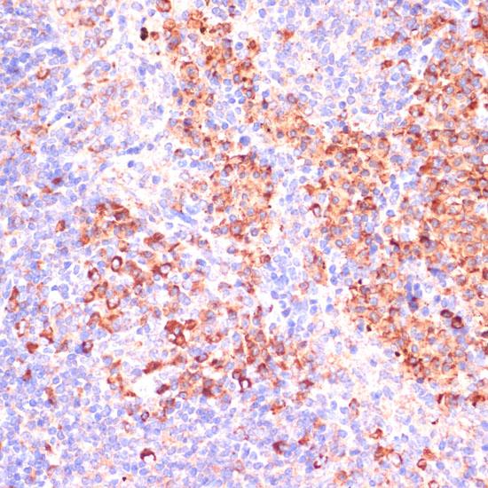 MZB1 Antibody - Immunohistochemistry of paraffin-embedded Mouse spleen using MZB1 Polyclonal Antibody at dilution of 1:100 (40x lens).