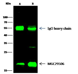 MZB1 Antibody - MGC29506 was immunoprecipitated using: Lane A: 0.5 mg Raji Whole Cell Lysate. Lane B: 0.5 mg Daudi Whole Cell Lysate. 2 uL anti-MGC29506 rabbit polyclonal antibody and 15 ul of 50% Protein G agarose. Primary antibody: Anti-MGC29506 rabbit polyclonal antibody, at 1:200 dilution. Secondary antibody: Dylight 800-labeled antibody to rabbit IgG (H+L), at 1:5000 dilution. Developed using the odssey technique. Performed under reducing conditions. Predicted band size: 20 kDa. Observed band size: 20 kDa.