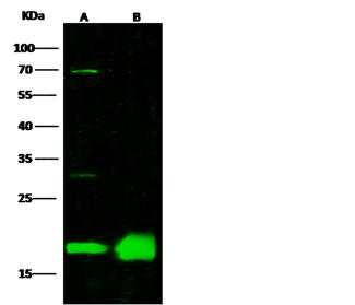 MZB1 Antibody - Anti-MGC29506 rabbit polyclonal antibody at 1:500 dilution. Lane A: Molt4 Whole Cell Lysate. Lane B: Raji Whole Cell Lysate. Lysates/proteins at 30 ug per lane. Secondary: Goat Anti-Rabbit IgG H&L (Dylight800) at 1/10000 dilution. Developed using the Odyssey technique. Performed under reducing conditions. Predicted band size: 21 kDa. Observed band size: 18 kDa. (We are unsure as to the identity of these extra bands.)