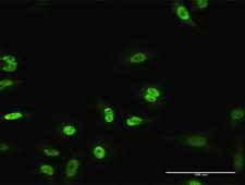 MZF / MZF1 Antibody - Immunofluorescence of monoclonal antibody to MZF1 on HeLa cell . [antibody concentration 6 ug/ml]