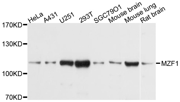 MZF / MZF1 Antibody - Western blot analysis of extracts of various cell lines, using MZF1 antibody at 1:1000 dilution. The secondary antibody used was an HRP Goat Anti-Rabbit IgG (H+L) at 1:10000 dilution. Lysates were loaded 25ug per lane and 3% nonfat dry milk in TBST was used for blocking. An ECL Kit was used for detection and the exposure time was 3s.