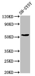 MZF / MZF1 Antibody - Positive Western Blot detected in SH-SY5Y whole cell lysate. All lanes: MZF1 antibody at 7.7 µg/ml Secondary Goat polyclonal to rabbit IgG at 1/50000 dilution. Predicted band size: 83, 55, 32 KDa. Observed band size: 55 KDa