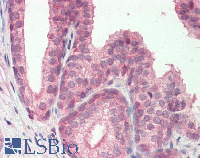 MZF / MZF1 Antibody - Human, Prostate: Formalin-Fixed Paraffin-Embedded (FFPE).  This image was taken for the unconjugated form of this product. Other forms have not been tested.