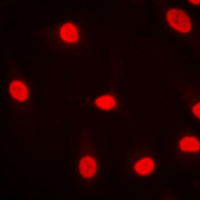 MZF / MZF1 Antibody - Immunofluorescent analysis of MZF1 staining in HeLa cells. Formalin-fixed cells were permeabilized with 0.1% Triton X-100 in TBS for 5-10 minutes and blocked with 3% BSA-PBS for 30 minutes at room temperature. Cells were probed with the primary antibody in 3% BSA-PBS and incubated overnight at 4 C in a humidified chamber. Cells were washed with PBST and incubated with a DyLight 594-conjugated secondary antibody (red) in PBS at room temperature in the dark. DAPI was used to stain the cell nuclei (blue).