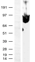 MZF / MZF1 Protein - Western validation with an anti-DDK antibody * L: Control HEK293 lysate R: Over-expression lysate