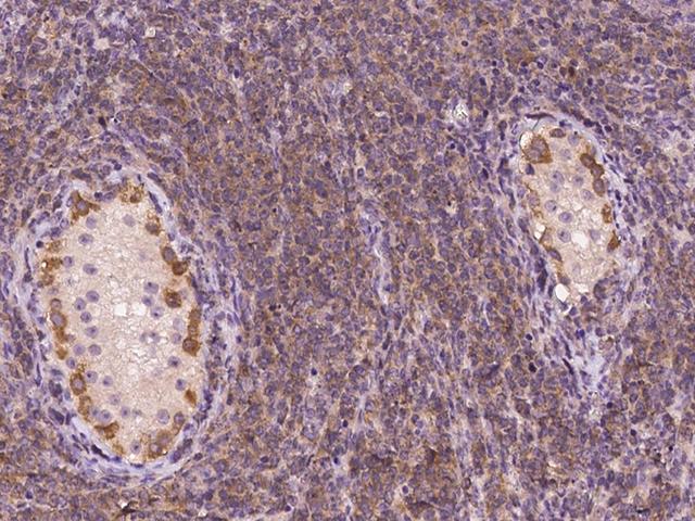 MZT2A / FAM128A Antibody - Immunochemical staining of human MZT2A in human testis with rabbit polyclonal antibody at 1:100 dilution, formalin-fixed paraffin embedded sections.