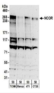N-CoR / NCOR1 Antibody - Detection of Mouse NCOR by Western Blot. Samples: Whole cell lysate (50 ug) from TCMK-1, Renca, 4T1, and CT26.WT cells. Antibodies: Affinity purified rabbit anti-NCOR antibody used for WB at 0.1 ug/ml. Detection: Chemiluminescence with an exposure time of 3 minutes.