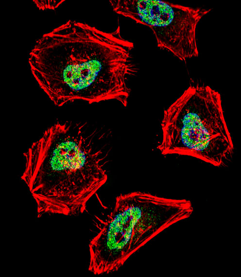 N-CoR / NCOR1 Antibody - Fluorescent confocal image of HeLa cell stained with (MOUSE) Ncor1 Antibody. HeLa cells were fixed with 4% PFA (20 min), permeabilized with Triton X-100 (0.1%, 10 min), then incubated with Ncor1 primary antibody (1:25, 1 h at 37°C). For secondary antibody, Alexa Fluor 488 conjugated donkey anti-rabbit antibody (green) was used (1:400, 50 min at 37°C). Cytoplasmic actin was counterstained with Alexa Fluor 555 (red) conjugated Phalloidin (7units/ml, 1 h at 37°C). Nuclei were counterstained with DAPI (blue) (10 ug/ml, 10 min). Ncor1 immunoreactivity is localized to nucleus significantly.
