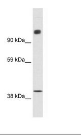 N-CoR / NCOR1 Antibody - Fetal Small intestine Lysate.  This image was taken for the unconjugated form of this product. Other forms have not been tested.