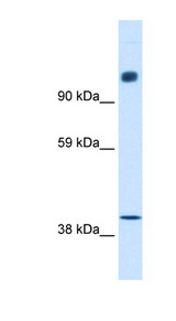 N-CoR / NCOR1 Antibody - NCOR1 / N-CoR antibody Western blot of Fetal small intestine lysate. This image was taken for the unconjugated form of this product. Other forms have not been tested.
