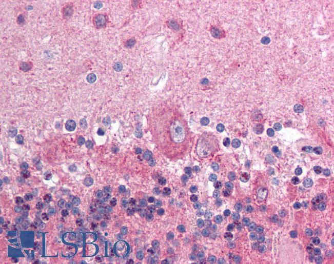 N-CoR / NCOR1 Antibody - Anti-NCOR1 / N-CoR antibody IHC of human brain, cerebellum. Immunohistochemistry of formalin-fixed, paraffin-embedded tissue after heat-induced antigen retrieval. Antibody concentration 5 ug/ml.  This image was taken for the unconjugated form of this product. Other forms have not been tested.