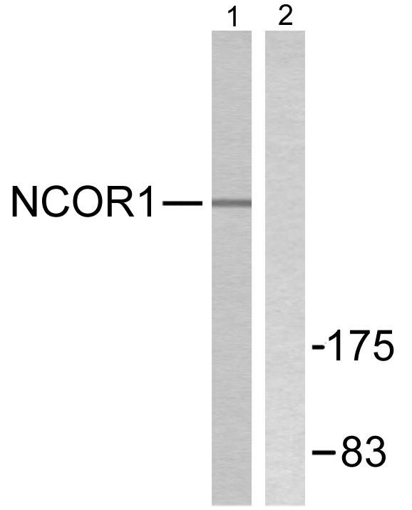 N-CoR / NCOR1 Antibody - Western blot analysis of lysates from MDA-MB-435 cells, using NCoR1 Antibody. The lane on the right is blocked with the synthesized peptide.