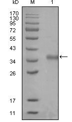 N-CoR / NCOR1 Antibody - NCoR1 Antibody in Western Blot (WB)