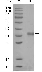 N-CoR / NCOR1 Antibody - Western blot using NCOR1 mouse monoclonal antibody against truncated Trx-NCOR1 recombinant protein (1).