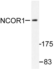 N-CoR / NCOR1 Antibody - Western blot of NCoR1 (H76) pAb in extracts from MDA-MB-435 cells.
