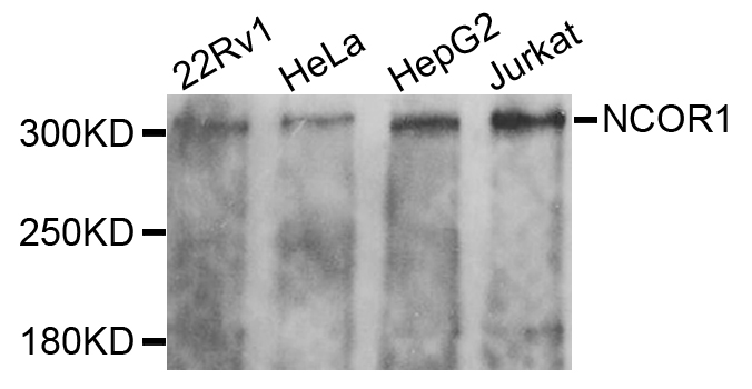 N-CoR / NCOR1 Antibody - Western blot analysis of extracts of various cells.