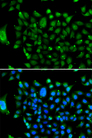N-CoR / NCOR1 Antibody - Immunofluorescence analysis of U20S cells.