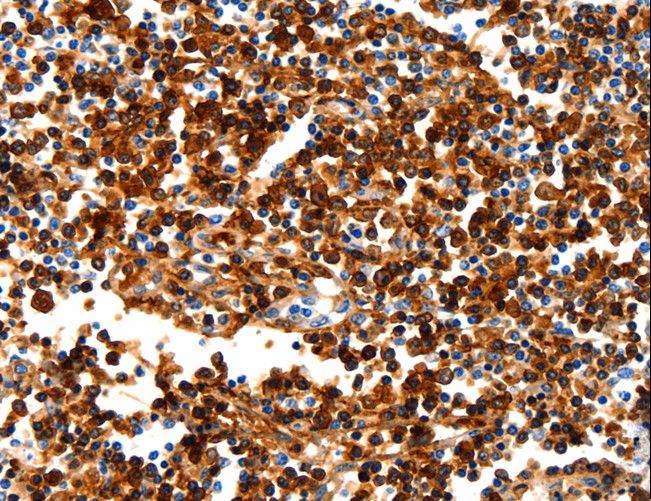 N-CoR / NCOR1 Antibody - Immunohistochemistry of paraffin-embedded Human tonsil using NCOR1 Polyclonal Antibody at dilution of 1:100.