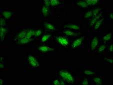 N-CoR / NCOR1 Antibody - Immunofluorescent analysis of Hela cells at a dilution of 1:100 and Alexa Fluor 488-congugated AffiniPure Goat Anti-Rabbit IgG(H+L)