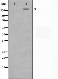 N-CoR / NCOR1 Antibody - Western blot analysis on MDA-MB-435 cell lysates using NCoR1 antibody. The lane on the left is treated with the antigen-specific peptide.