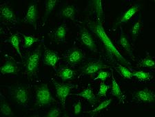 N-CoR / NCOR1 Antibody - Immunofluorescence staining of NCOR1 in Hela cells. Cells were fixed with 4% PFA, permeabilzed with 0.1% Triton X-100 in PBS, blocked with 10% serum, and incubated with rabbit anti-Human NCOR1 polyclonal antibody (dilution ratio 1:200) at 4°C overnight. Then cells were stained with the Alexa Fluor 488-conjugated Goat Anti-rabbit IgG secondary antibody (green). Positive staining was localized to Nucleus and cytoplasm.