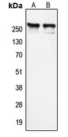 N-CoR / NCOR1 Antibody - Western blot analysis of NCOR1 expression in K562 (A); HeLa (B) whole cell lysates.