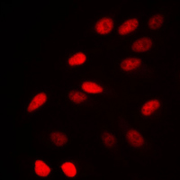 N-CoR / NCOR1 Antibody - Immunofluorescent analysis of NCOR1 staining in HeLa cells. Formalin-fixed cells were permeabilized with 0.1% Triton X-100 in TBS for 5-10 minutes and blocked with 3% BSA-PBS for 30 minutes at room temperature. Cells were probed with the primary antibody in 3% BSA-PBS and incubated overnight at 4 C in a humidified chamber. Cells were washed with PBST and incubated with a DyLight 594-conjugated secondary antibody (red) in PBS at room temperature in the dark. DAPI was used to stain the cell nuclei (blue).