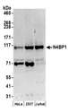 N4BP1 Antibody - Detection of human N4BP1 by western blot. Samples: Whole cell lysate (50 µg) from HeLa, HEK293T, and Jurkat cells prepared using NETN lysis buffer. Antibodies: Affinity purified rabbit anti-N4BP1 antibody used for WB at 0.1 µg/ml. Detection: Chemiluminescence with an exposure time of 3 minutes.