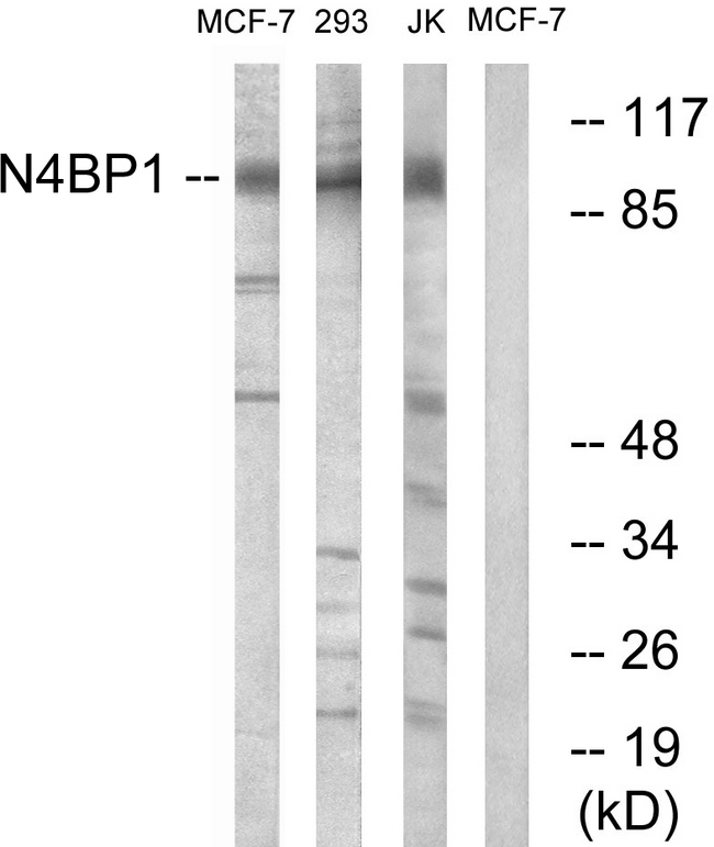 N4BP1 Antibody - Western blot analysis of lysates from MCF-7 and Jurkat/293 cells, using N4BP1 Antibody. The lane on the right is blocked with the synthesized peptide.