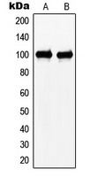 N4BP1 Antibody - Western blot analysis of N4BP1 expression in HeLa (A); Jurkat (B) whole cell lysates.