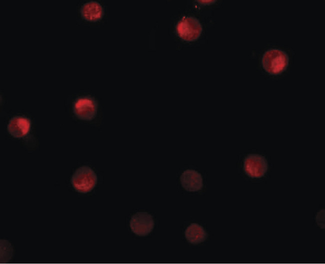 N4BP1 Antibody - Immunofluorescence of N4BP1 in HeLa cells with N4BP1 antibody at 20 ug/ml.