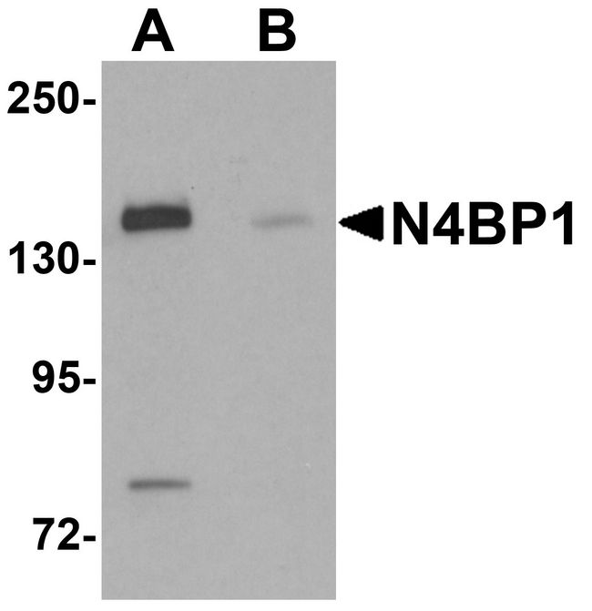 N4BP1 Antibody - Western blot analysis of N4BP1 in HeLa cell lysate with N4BP1 antibody at 0.5 ug/ml in (A) the absence and (B) the presence of blocking peptide.