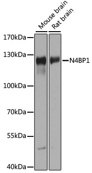 N4BP1 Antibody - Western blot analysis of extracts of various cell lines, using N4BP1 antibody at 1:1000 dilution. The secondary antibody used was an HRP Goat Anti-Rabbit IgG (H+L) at 1:10000 dilution. Lysates were loaded 25ug per lane and 3% nonfat dry milk in TBST was used for blocking. An ECL Kit was used for detection and the exposure time was 60s.
