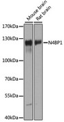 N4BP1 Antibody - Western blot analysis of extracts of various cell lines, using N4BP1 antibody at 1:1000 dilution. The secondary antibody used was an HRP Goat Anti-Rabbit IgG (H+L) at 1:10000 dilution. Lysates were loaded 25ug per lane and 3% nonfat dry milk in TBST was used for blocking. An ECL Kit was used for detection and the exposure time was 60s.