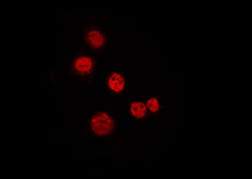 N4BP1 Antibody - Staining HeLa cells by IF/ICC. The samples were fixed with PFA and permeabilized in 0.1% Triton X-100, then blocked in 10% serum for 45 min at 25°C. The primary antibody was diluted at 1:200 and incubated with the sample for 1 hour at 37°C. An Alexa Fluor 594 conjugated goat anti-rabbit IgG (H+L) Ab, diluted at 1/600, was used as the secondary antibody.