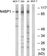 N4BP1 Antibody - Western blot analysis of extracts from MCF-7 cells, 293 cells and Jurkat cells, using N4BP1 antibody.