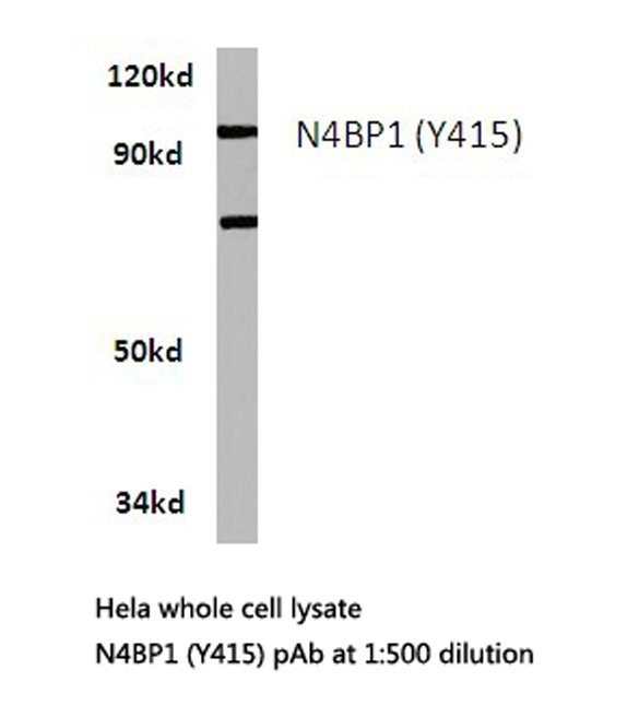 N4BP1 Antibody - Western blot of N4BP1 (Y415) pAb in extracts from HeLa cells.