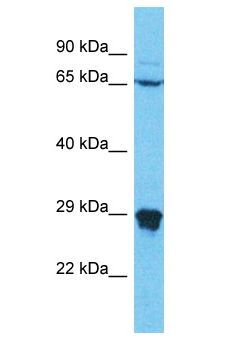 N4BP2L1 Antibody - N4BP2L1 antibody Western Blot of RPMI-8226. Antibody dilution: 1 ug/ml.  This image was taken for the unconjugated form of this product. Other forms have not been tested.
